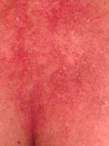 No, that's not cleavage... armpit. Miserable!